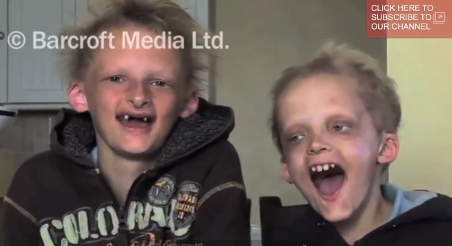 video Αδέρφια βρικόλακες πάσχουν από βαμπιρισμό